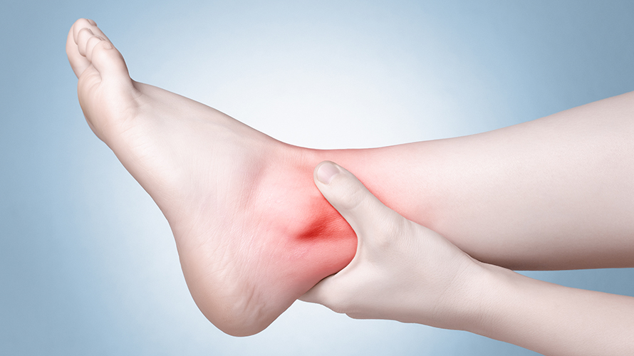 Ankle Arthritis, Ankle Arthritis Treatment & Surgery