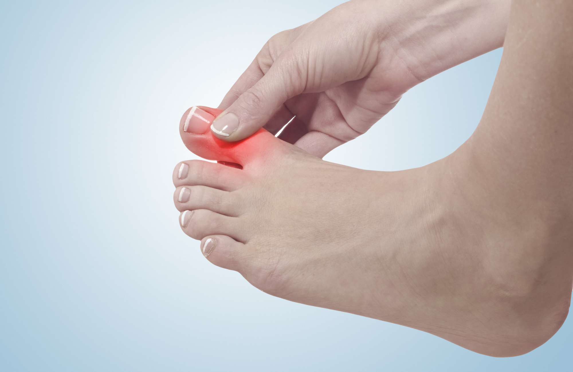 Big Toe Arthritis (Hallux Rigidus) Symptoms & Causes